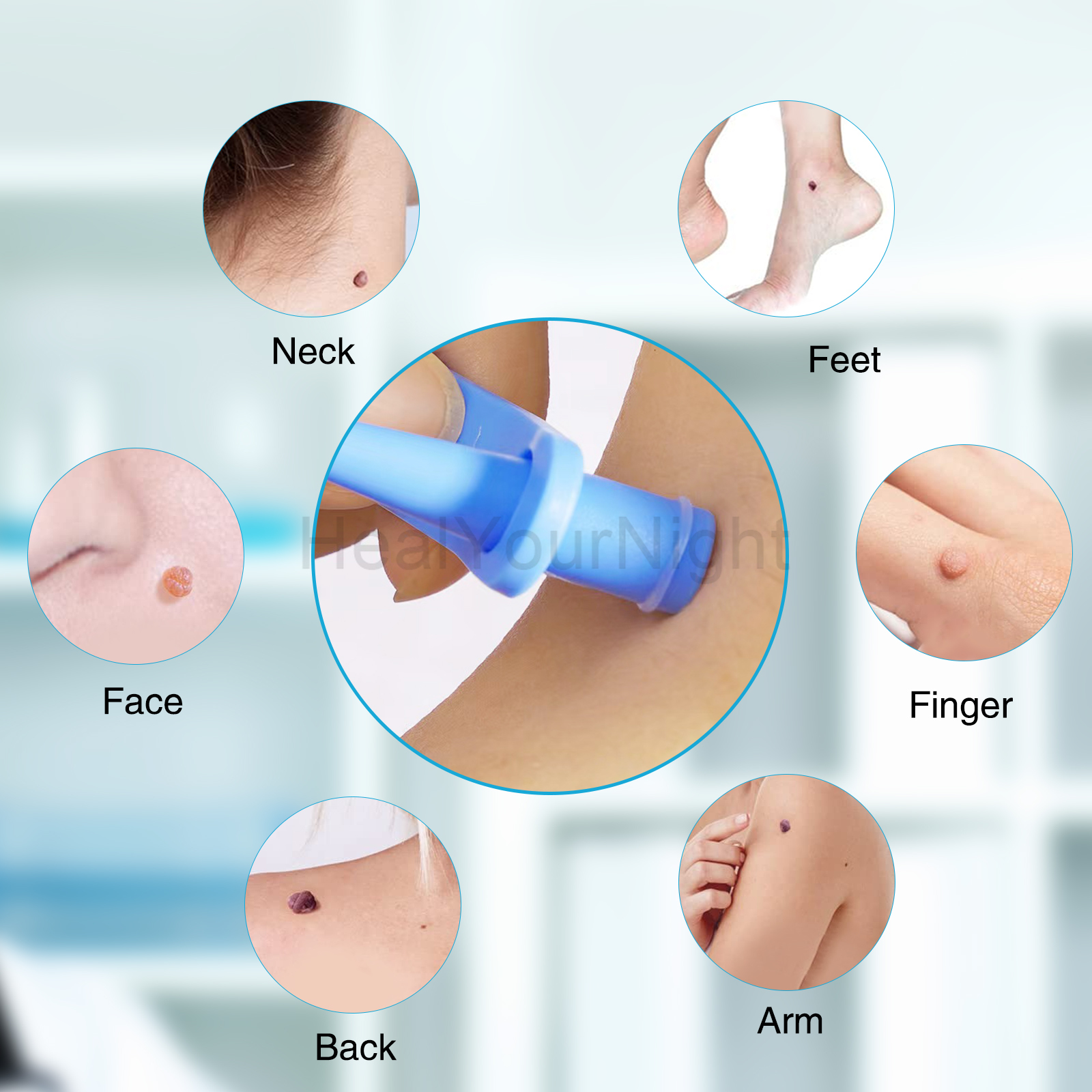 3-IN-1 Auto Skin Tag Removal K - Acne Light Therapy Pen incelemesi ve fiyatı