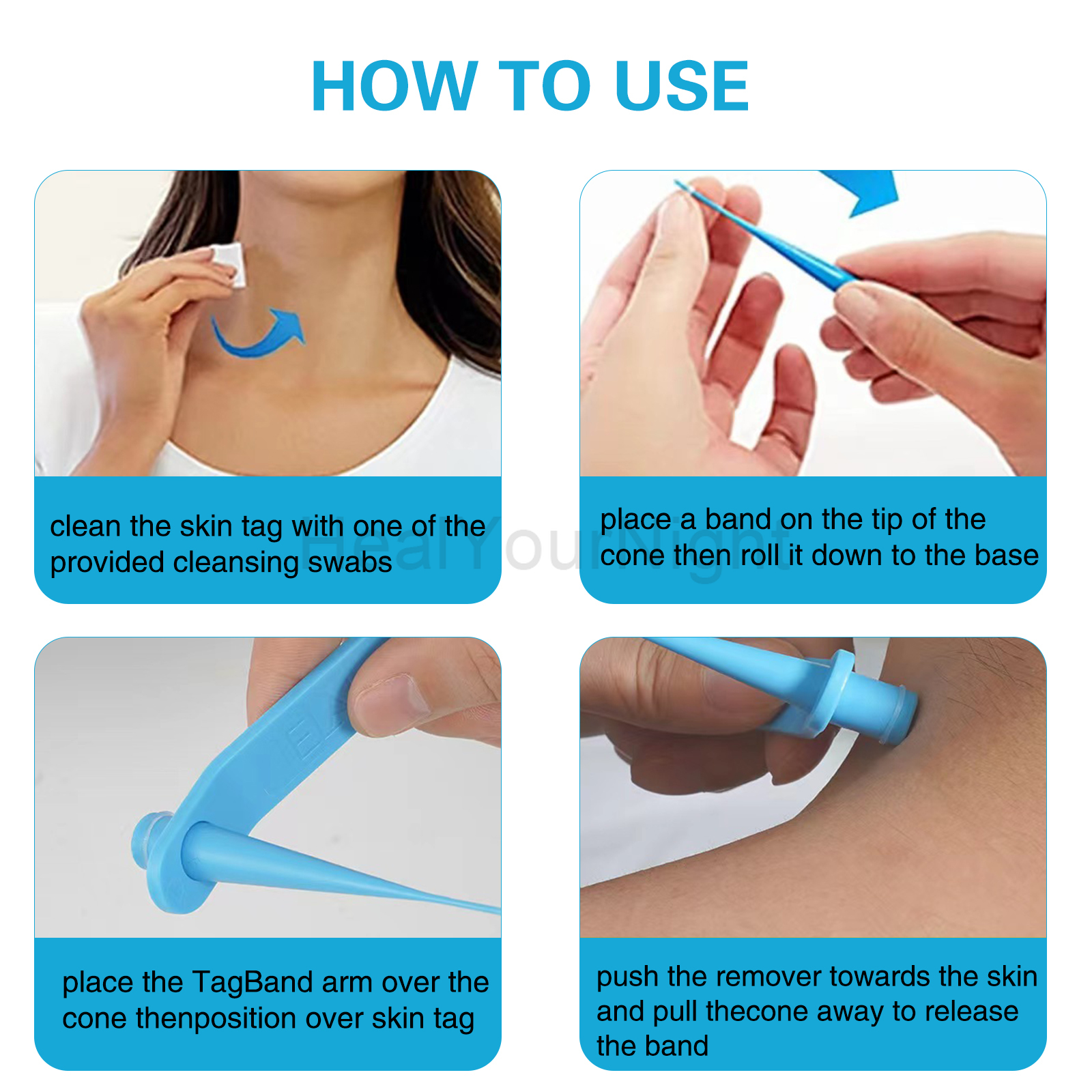 3-IN-1 Auto Skin Tag Removal K - Acne Light Therapy Pen incelemesi ve fiyatı