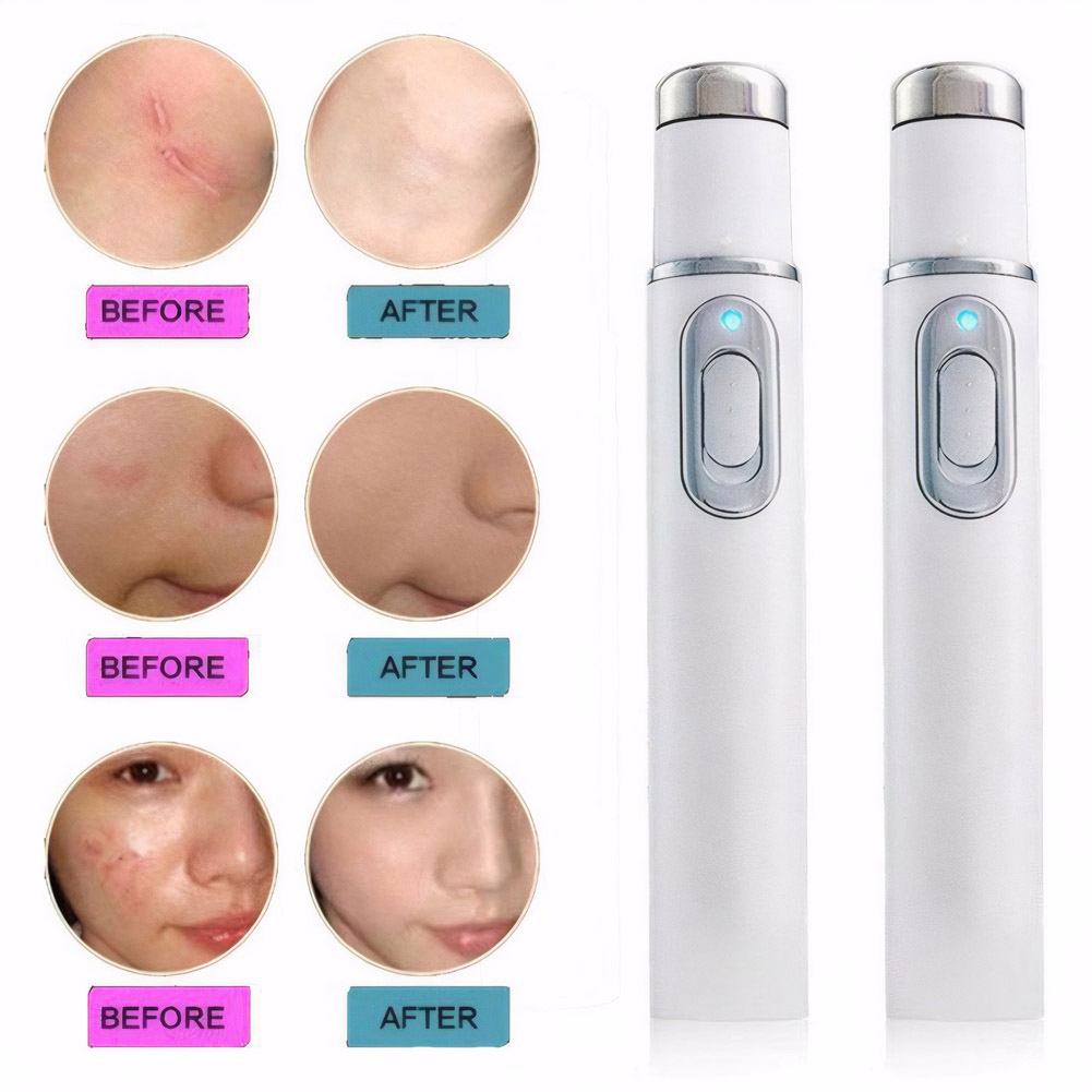 Blue Light Therapy Acne Pen He - Acne Light Therapy Pen incelemesi ve fiyatı