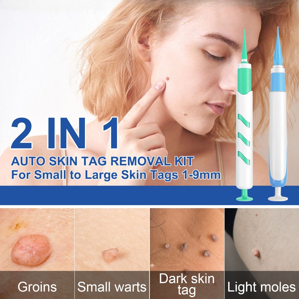 2-IN-1 Auto Skin Tag Removal T - Acne Light Therapy Pen incelemesi ve fiyatı