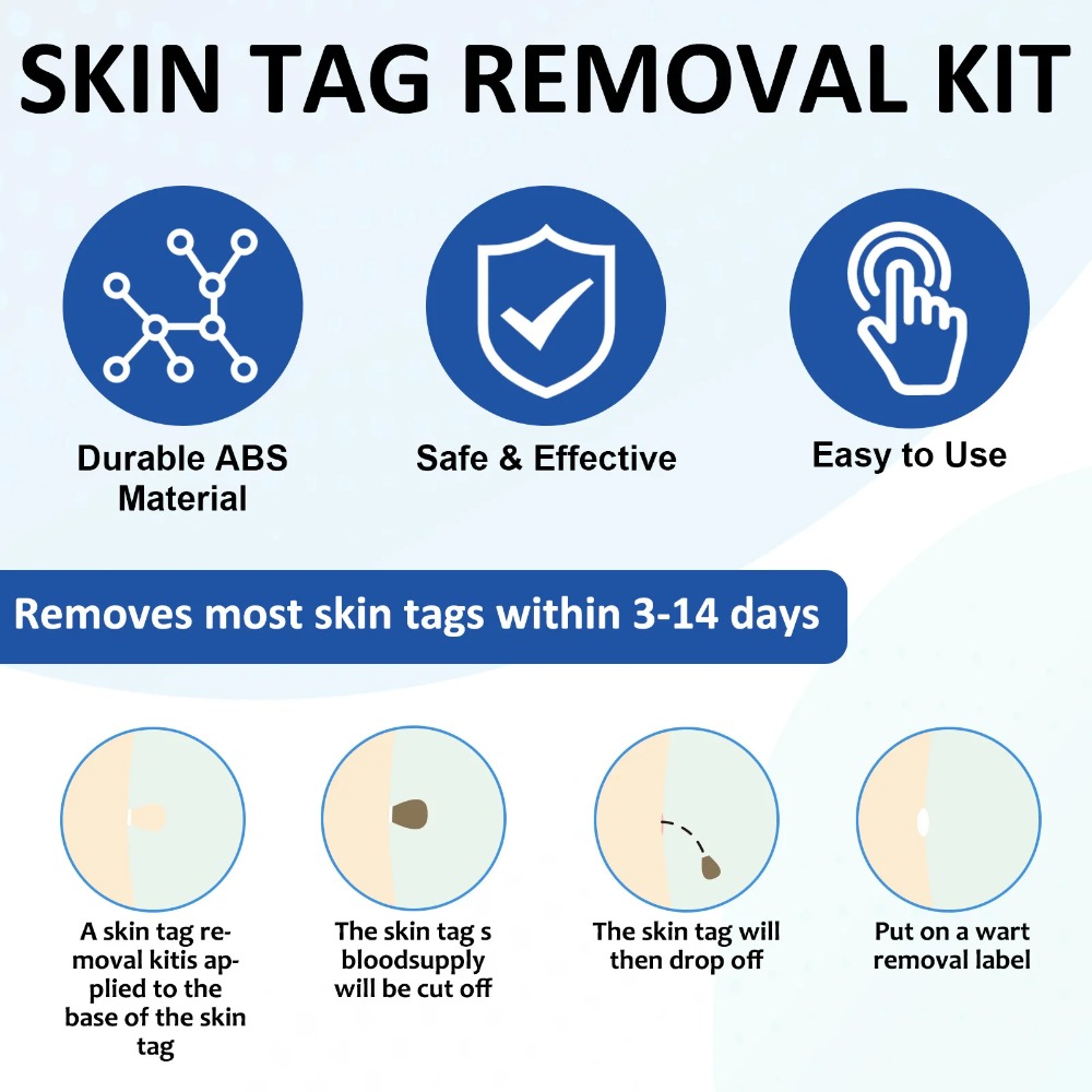 2-IN-1 Auto Skin Tag Removal T - Acne Light Therapy Pen incelemesi ve fiyatı