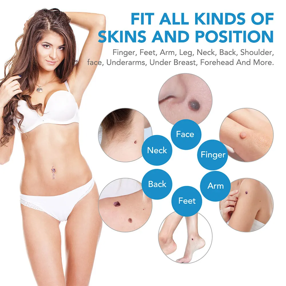 Auto Skin Tag Removal Tool Kit - Acne Light Therapy Pen incelemesi ve fiyatı